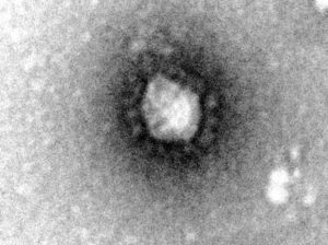 新型コロナウイルスの写真